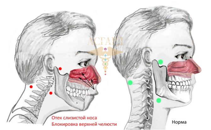 Чем лечить заложенность носа?