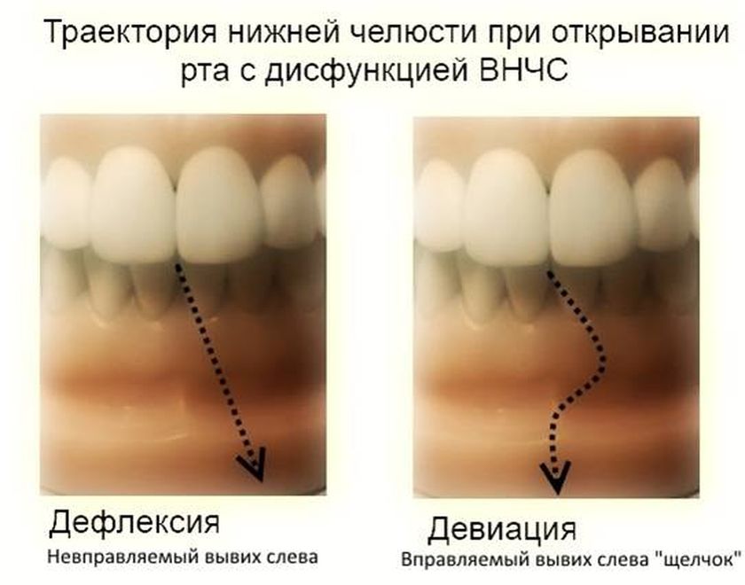 Упражнения для височно-нижнечелюстного сустава | Статьи от Медики